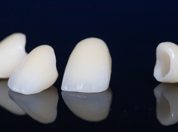 Root Canal Done, Now What? Understanding the Need for a Crown
