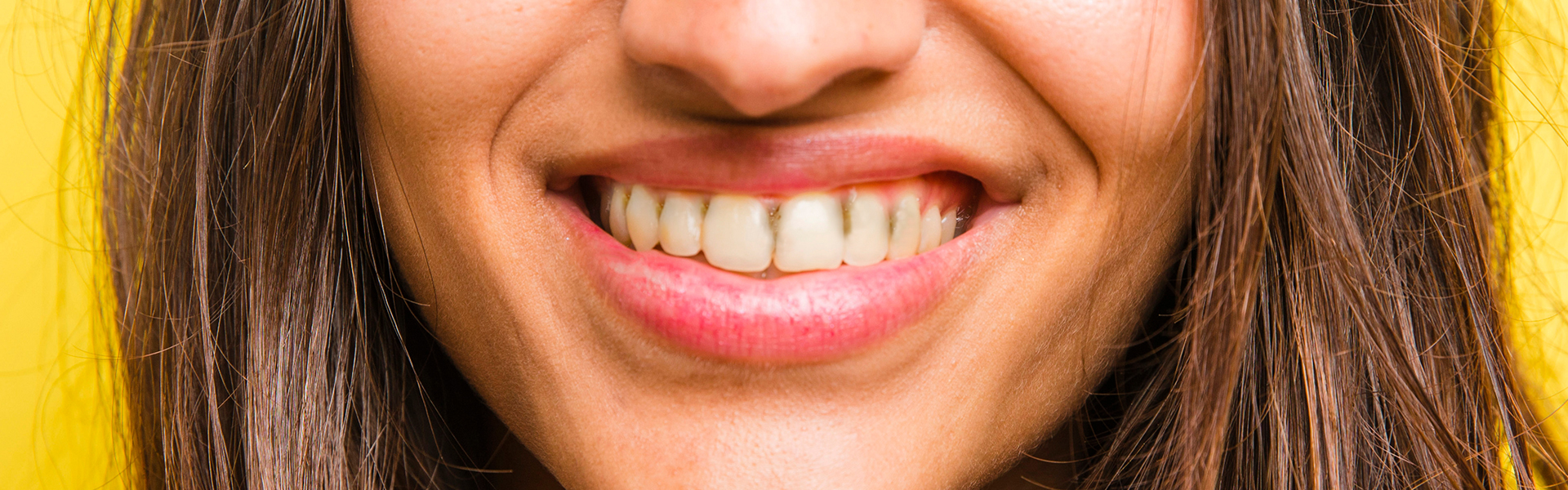 Sudden Brown Stains on Teeth: Causes and Solutions