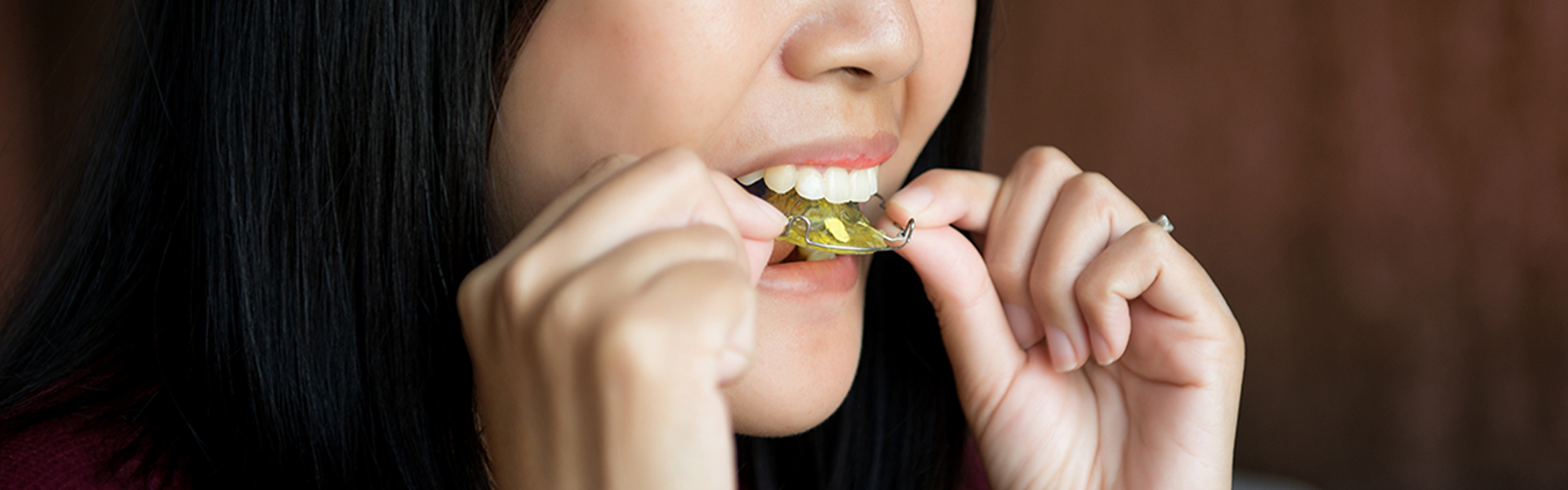 When Can You Stop Wearing Your Retainers? Here’s What You Need to Know