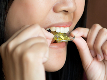 When Can You Stop Wearing Your Retainers? Here’s What You Need to Know
