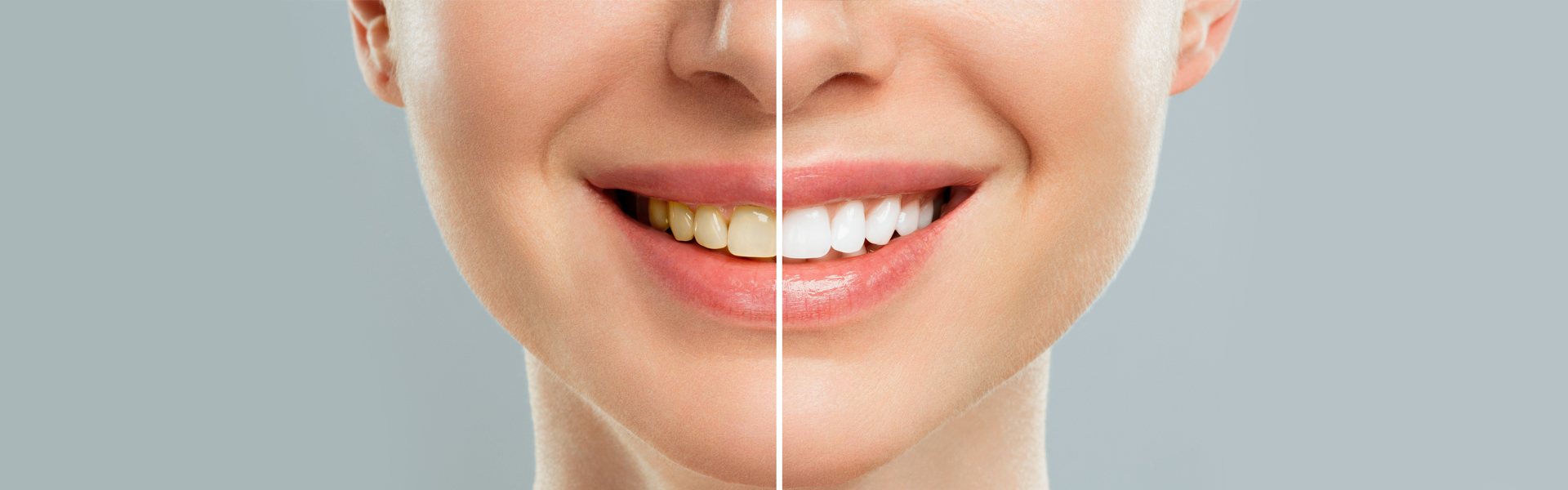 What Your Tooth Shade Says About Your Oral Health